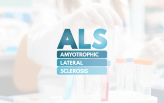 Can an ASO Reduce Disease Progression in ALS?